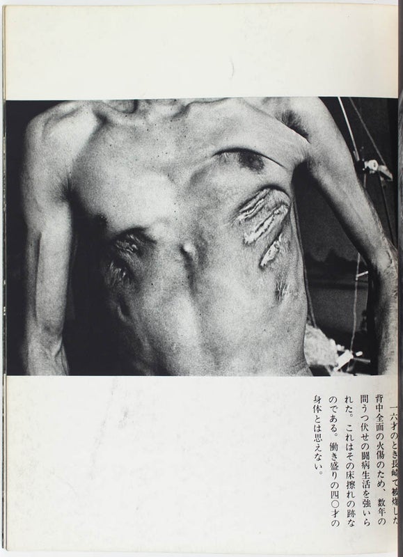 Non: Volume 1: Han-sen Eno Shisaku / For Antiwar Thoughts.